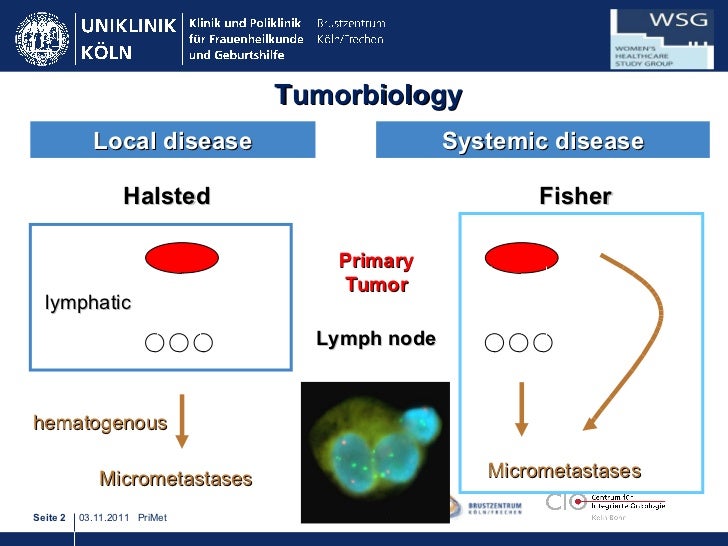 breast cancer disease r Pact study for breast cancer